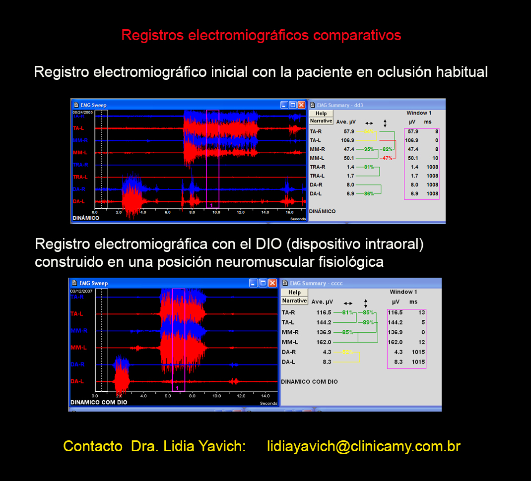 15 registro eletromiografico comparativo
